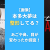 【画像】本多大夢は整形してる？あごや鼻、目が変わったか調査！