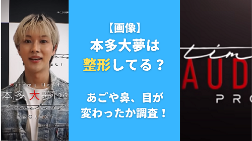 【画像】本多大夢は整形してる？あごや鼻、目が変わったか調査！